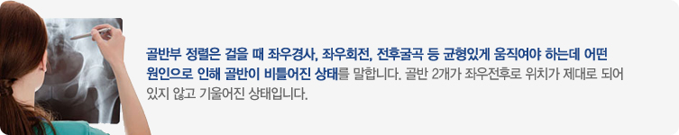 °ñ¹ÝºÎÁ¤·Ä